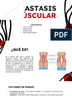Diastasis Muscular 28.06