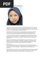 Download Bell Palsy by prefid SN59338317 doc pdf