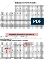 Interpretation Des ECG (Cahier D'exam)