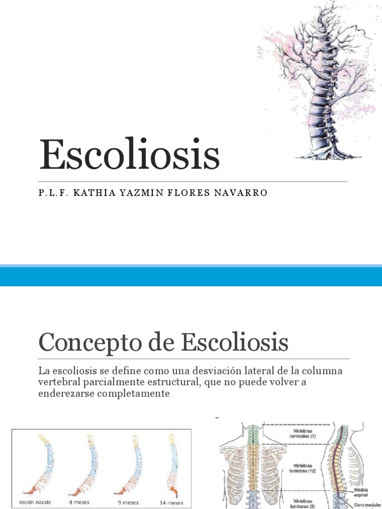 Escoliosis | PDF | La columna vertebral | Escoliosis