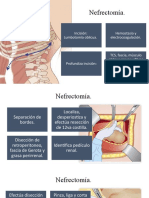 Nefrectomía