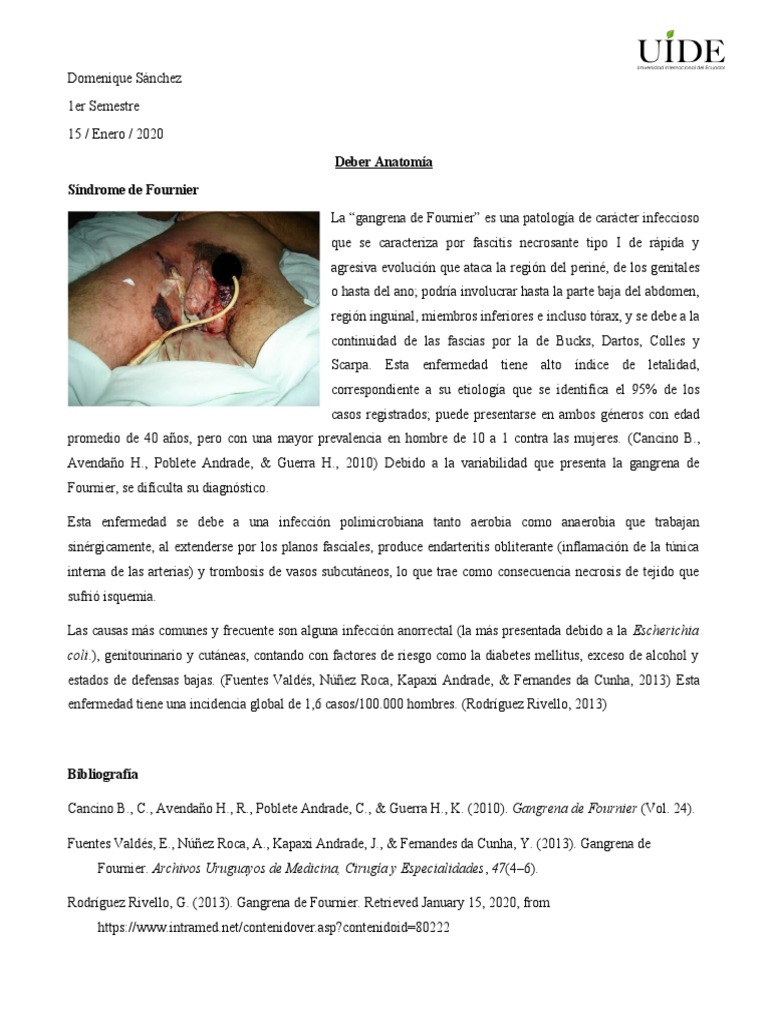 Síndrome de Fournier PDF Causas de la muerte Enfermedades y trastornos