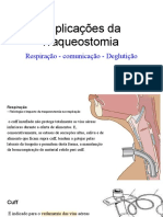 Implicações Da Traqueostomia