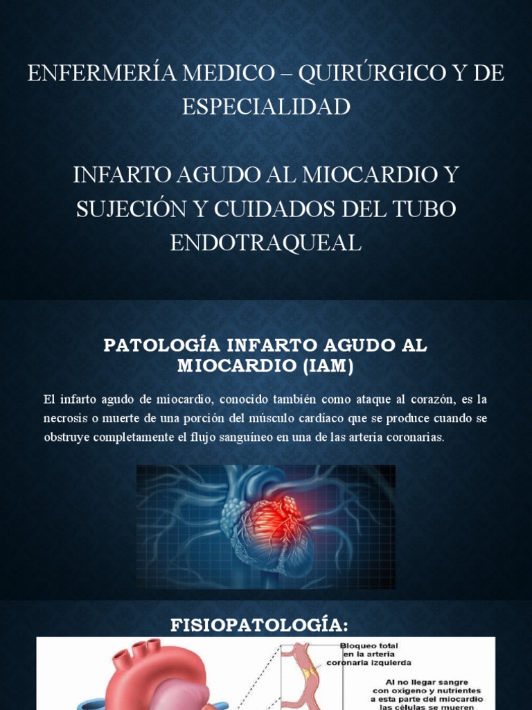 Infarto Agudo Al Miocardio | PDF | Infarto de miocardio | Sistema ...