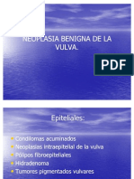 Neoplasias Benignas de La Vulva