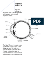 Visual Impairment