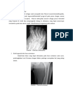 Diagnosis Banding. Refarat Dhila