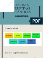 Lesiones Eruptivas Infantiles