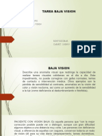 Tarea Baja Vision