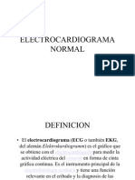 Electrocardiogram A Normal