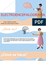 ELECTROENCEFALOGRAMA