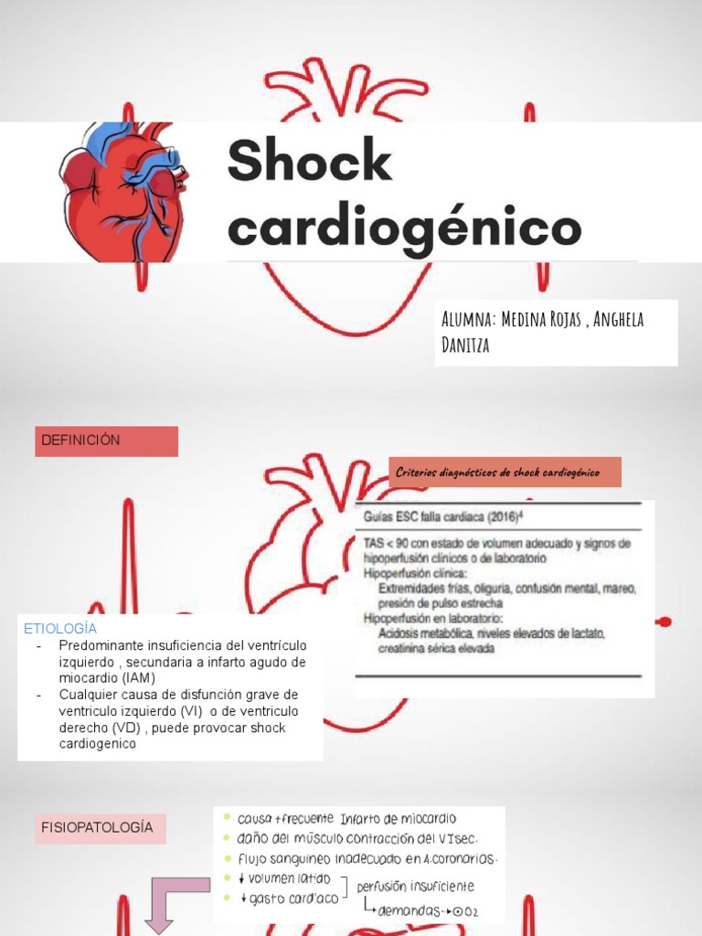 Shock Cardiogénico | Shock cardiogénico: síntomas, causas y tratamiento ...