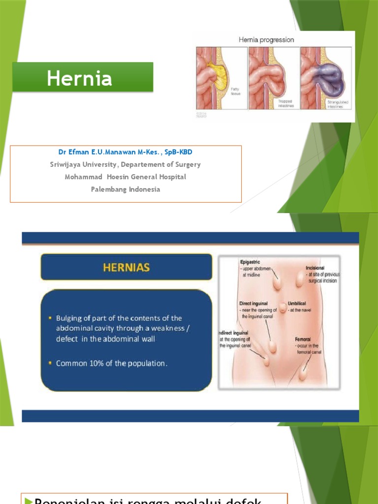Hernia PDF