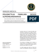 Polidactilia Familiar: Dedos Supernumerarios: Imagen Médica