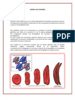 Anemia Falciformes Limpio