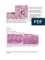 Neoplasias