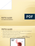 Peptic Ulcer