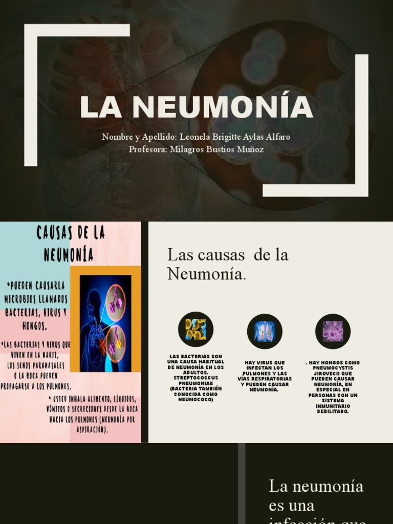 Neumonia Pdf