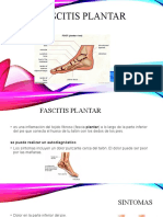 Fascitis plantar