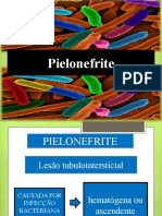 7 - Pielonefrite