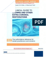 Crowns and Other Extra-coronal Restoration