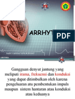 cara baca ekg aritmia dodi