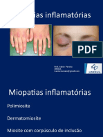 Aula Miopatias Inflamatórias - Dr. Ivânio Pereira