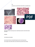 GEJALA HISTOPLASMOSIS