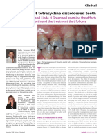 Clinical Management and Treatment of Tetracycline-Stained Teeth
