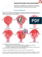 Mola Hidatidiforme: Causas, Tipos y Tratamiento de la Enfermedad Trofoblástica Gestacional (ETG