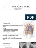 Fraktur Iga & Flail Chest