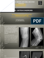 Osteocondroma - Caso Clinico-Radiologico