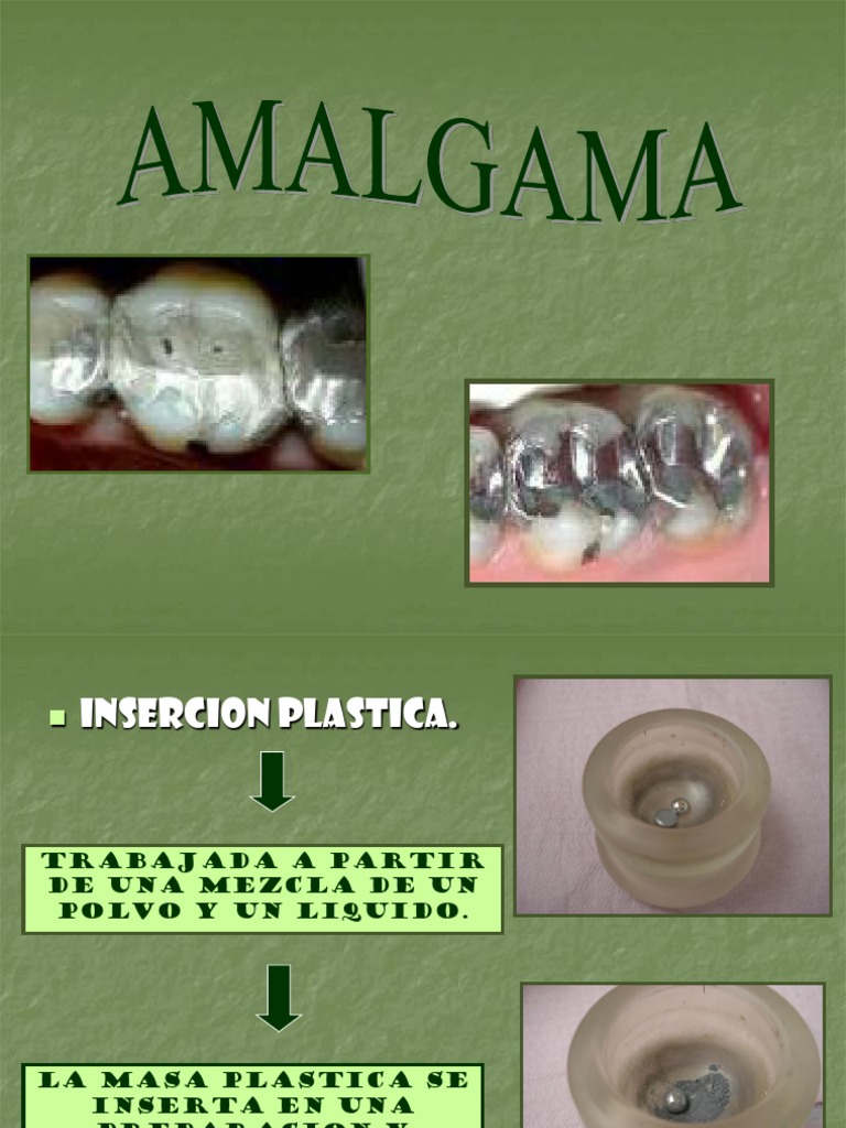 AMALGAMA PDF Aleación Cobre