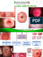 Patologia Cervical