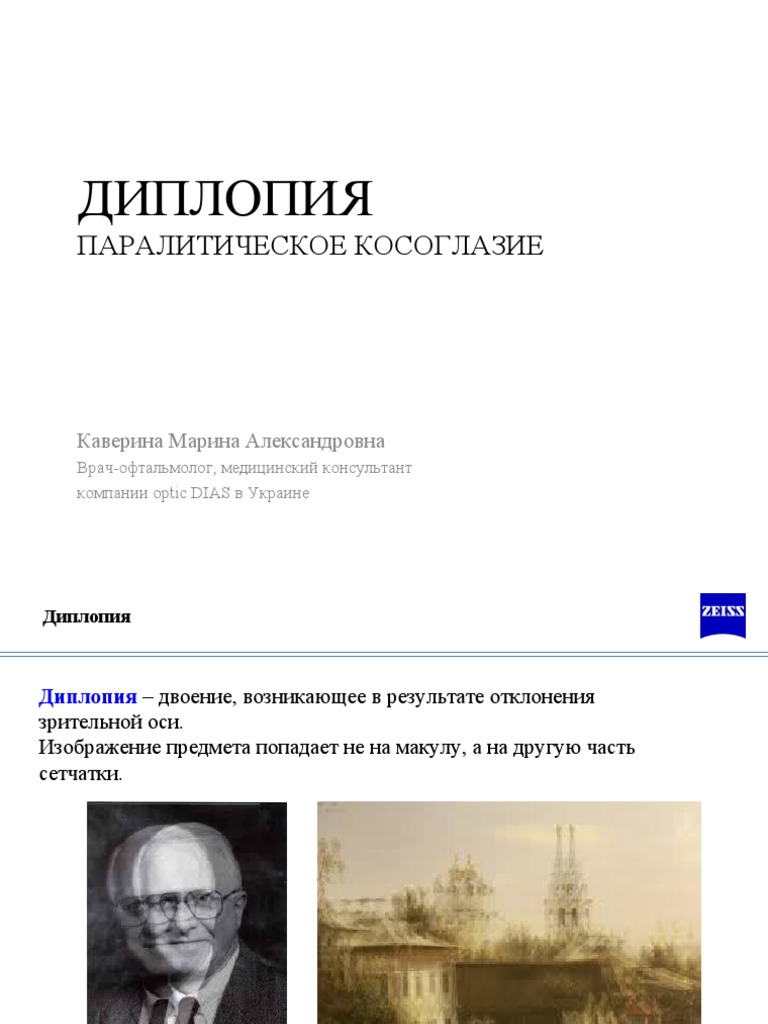 5. Диплопия 2 | PDF