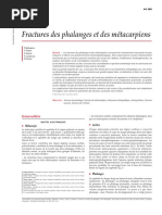 Fractures des phalanges et des métacarpiens