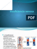 Insuficiencia Venosa