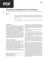 Évolutions techniques de la césarienne