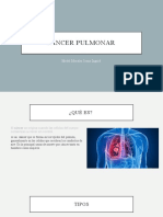 Cáncer Pulmonar