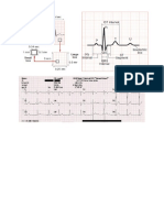 Ekg