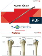 Técnica quirúrgica de osteosíntesis con clavo endomedular para fracturas de húmero