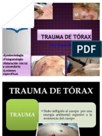 Trauma de tórax