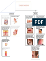 Clasificación de Los Tipos de Heridas