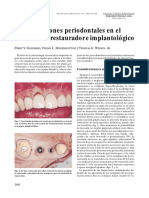 Consideraciones Perio en El Tto Perio e Implantes