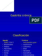 Gastritis crónica causas y tratamiento