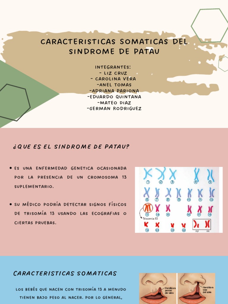 Presentacion Sindrome Patau | PDF