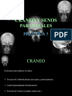 PRÁCTICA 05 - Cráneo y Senos Paranasales