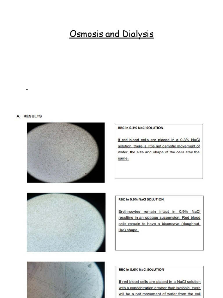 Osmosis And Dialysis Download Free Pdf Osmosis Blood