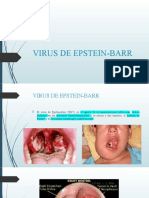 VIRUS DE EPSTEIN-BARR
