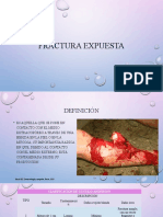 FracturA EXPUESTA